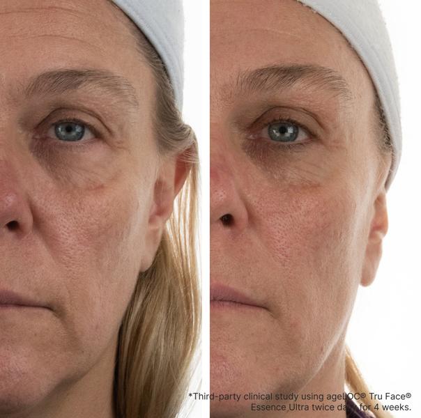 Nu Skin ageLOC® Tru Face® Essence Ultra refill 60 cápsulas MY - NewSkinShop